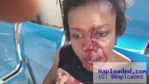 Photo: Update on the woman whose husband battered & inflicted deep cut on her